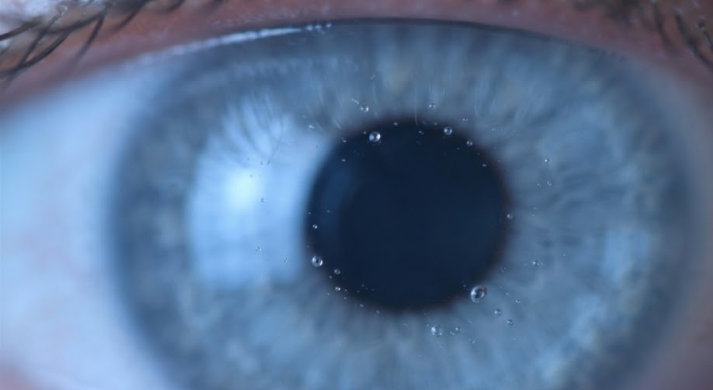 Macro photograph of a healthy human eye focusing on the tear film and meibum oil droplets